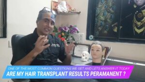 Read more about the article What is the Success Rate of Hair Transplant ? Will my Hair Fall Again after the surgery ?