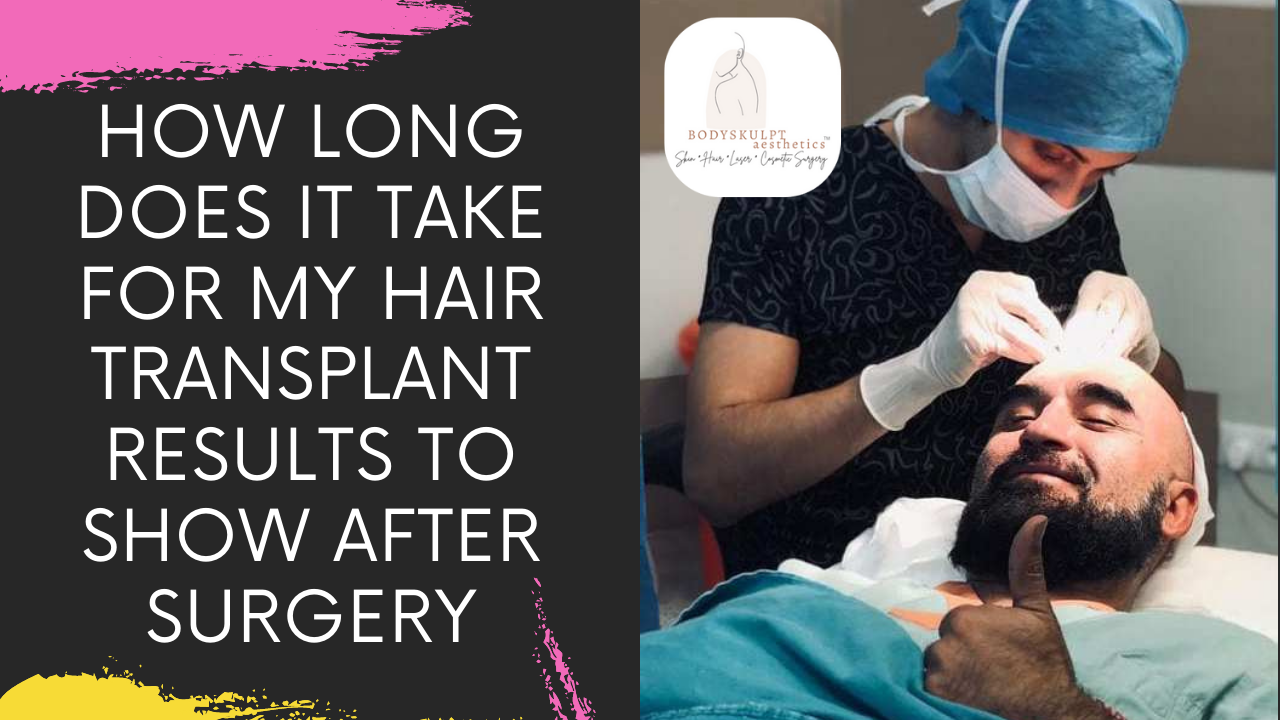 Read more about the article HOW LONG DOES IT TAKE FOR HAIR TRANSPLANT RESULTS TO SHOW AFTER HAIR RESTORATION SURGERY IN MUMBAI