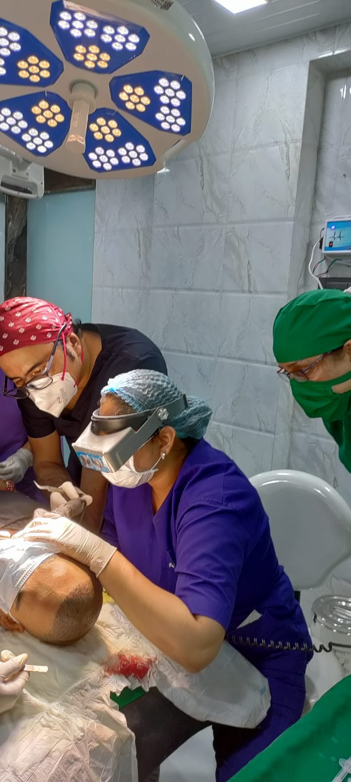 Read more about the article High Density Hair Transplant in Navi Mumbai