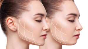 Read more about the article Buccal Fat Removal: Procedure, Candidates, Cost in Navi Mumbai