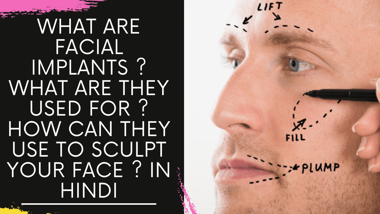 You are currently viewing What are Facial Implants ? what are they used for ? How can they use to sculpt your face ?