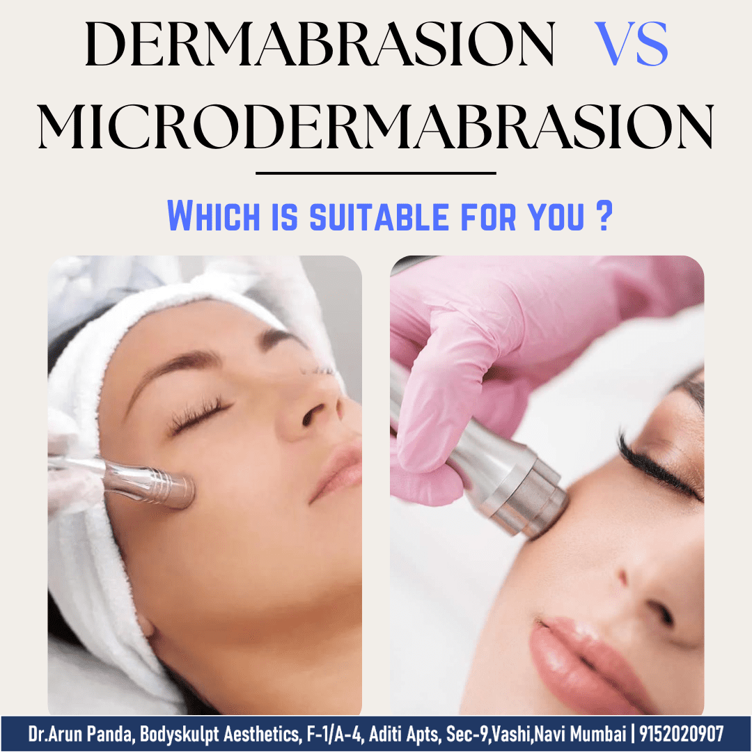 Read more about the article Dermabrasion vs Microdermabrasion? Explained by Dr. Arun Panda