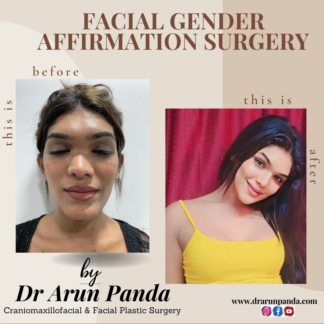 You are currently viewing FACIAL GENDER AFFIRMATION SURGERY