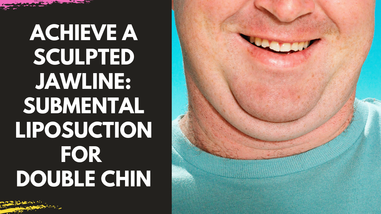 Read more about the article Achieve a Sculpted Jawline: Submental Liposuction for Double Chin in Mumbai by Dr Arun Panda