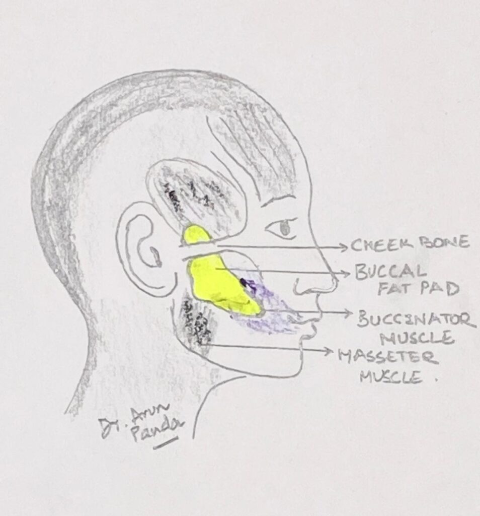 Hand-drawn sketch of buccal fat removal surgery in Navi Mumbai showing internal anatomy, incision site, and fat pad removal process.